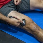 Rullo massaggiante freddo 1